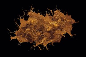 The Impact of Obesity on Liver Health and Strategies for Reversal
